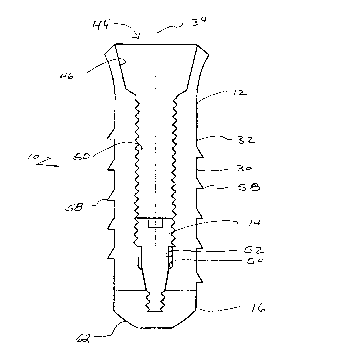 Une figure unique qui représente un dessin illustrant l'invention.